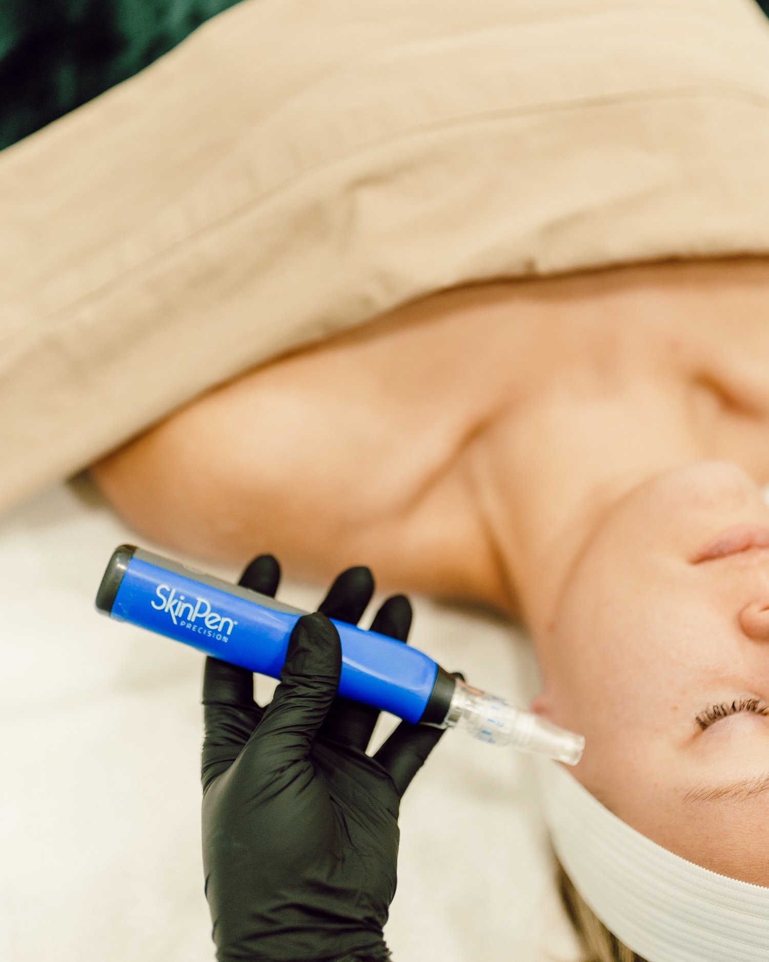 SkinPen Microneedling